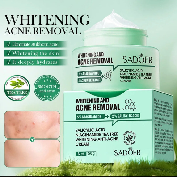 کرم ضد جوش صورت سادور مدل ANTI-ACNE مناسب برای پوست آکنهای وزن 50 گرم