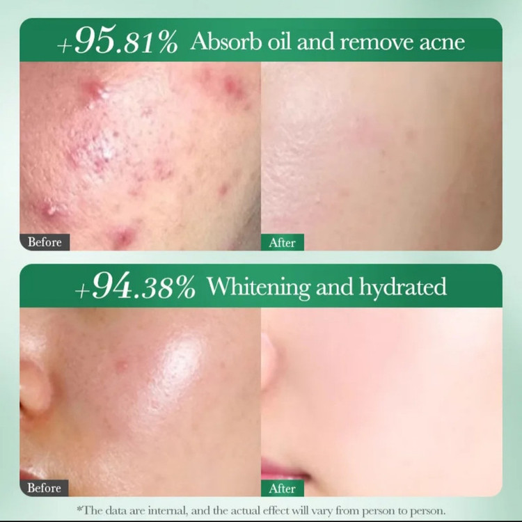 تونر پاککننده صورت سادور مدل ANTI-ACNE مناسب برای پوست آکنهای حجم 130 میلیلیتر